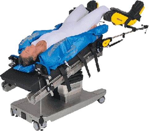 png-clipart-trendelenburg-position-surgery-operating-table-gynaecology-allen-medical-systems-inc-transoral-robotic-surgery-medicine-surgery-removebg-preview